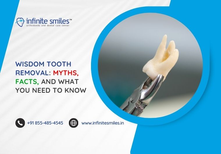 Wisdom Tooth Removal: Myths, Facts, And What You Need To Know